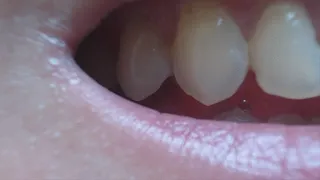 3 MINUTES TEETH IN CLOSE UP