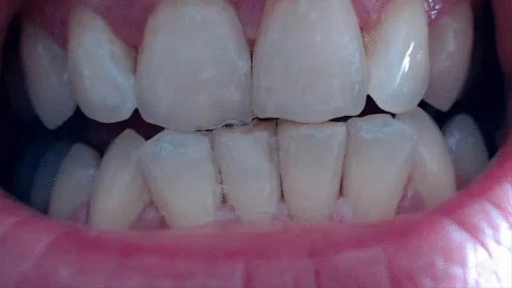 20 minutes of my teeth in close up to cam