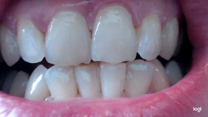 20 minutes of my lovely white teeth to cam