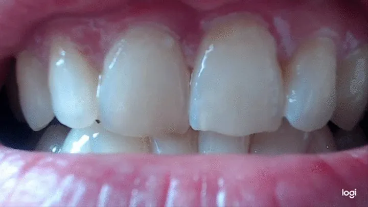 12 minutes of my lovely and white teeth to cam