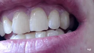 9 minutes with white teeth to cam