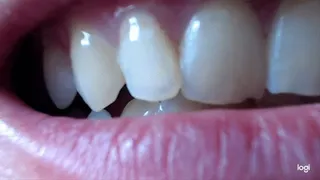 30 minutes of white pointy teeth