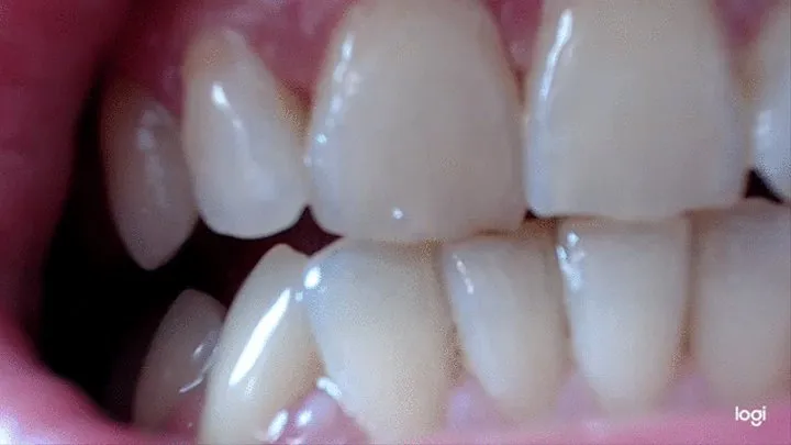 10 minutes of my wonderful white teeth to cam