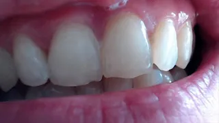 2 minutes gorgeous white teeth to cam