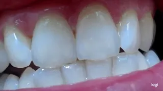 12 minutes of my nice teeth in close up to cam