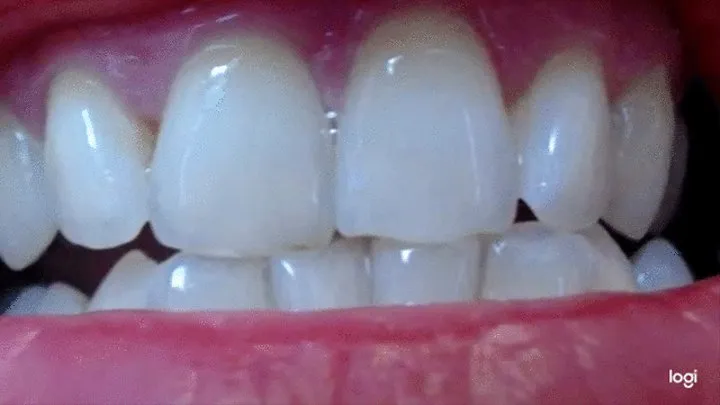 9 minutes of white and pointy teeth to cam