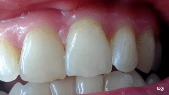 2 minutes white teeth in close up to cam