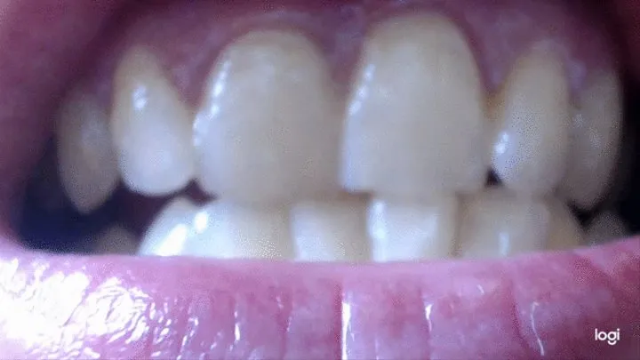 My white teeth to cam in extremly close-ups