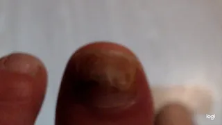 Ugly big toe in close up