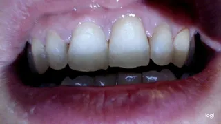 10 minutes of white pointy teeth in extremly close-up