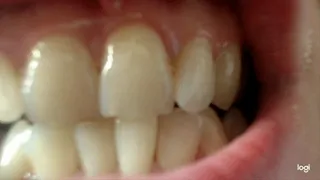 2 minutes of white teeth to cam