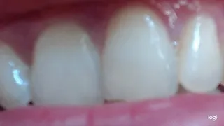 My white teeth in extremly close up to cam