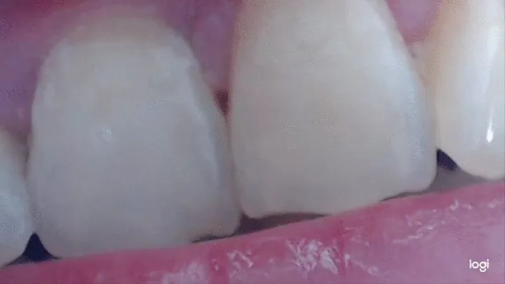 2 minutes my teeth in close up to cam