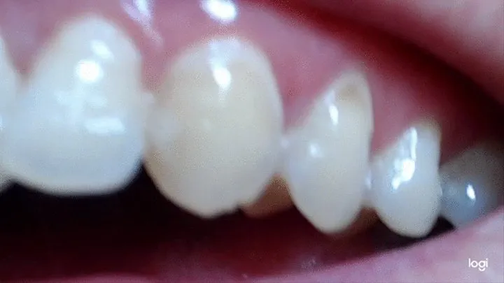 My teeth in extremly closeup to cam