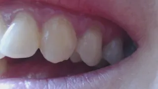 14 minutes teeth in close - up to cam
