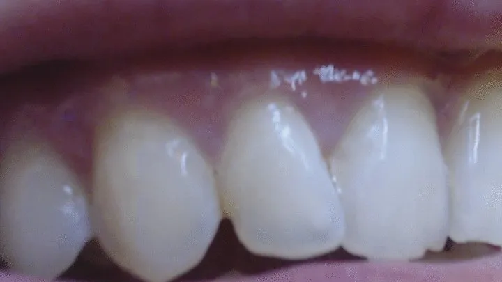 16 minutes teeth in extremly close up to cam