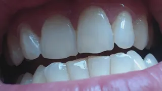 4 minutes spending with my teeth