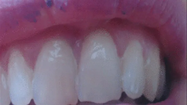 31 minutes amateur video with teeth in big close ups