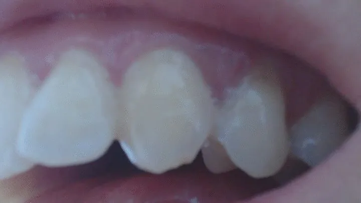 22 minutes of my canines in big close up