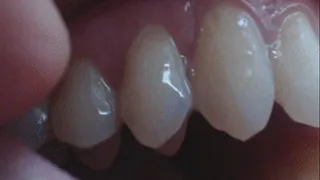 6 minutes of vampire teeth to cam