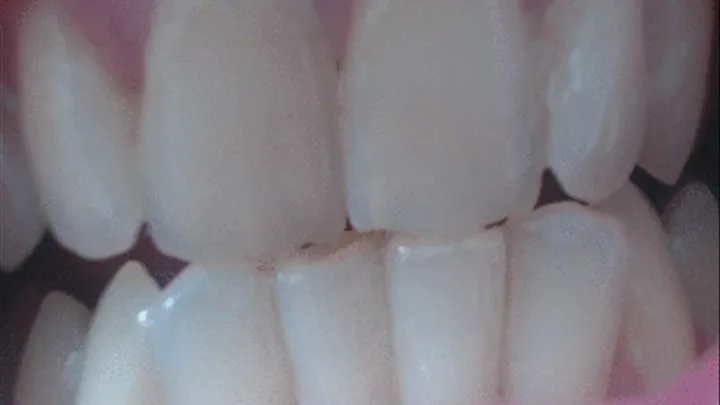 8 minutes close up of my teeth to cam