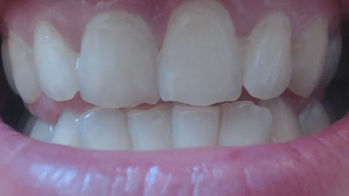 10 minutes close up of my shiny teeth