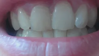 2 minutes quick video of close up of teeth
