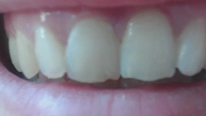 5 minutes of close up of my beauty teeth