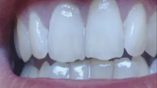 35 minutes of close up of my teeth to cam