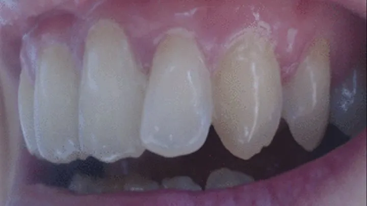 32 minutes my total pearls white teeth to cam