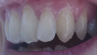 32 minutes my total pearls white teeth to cam