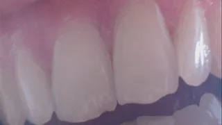 5 minutes with my lovely white teeth from front to cam in close up