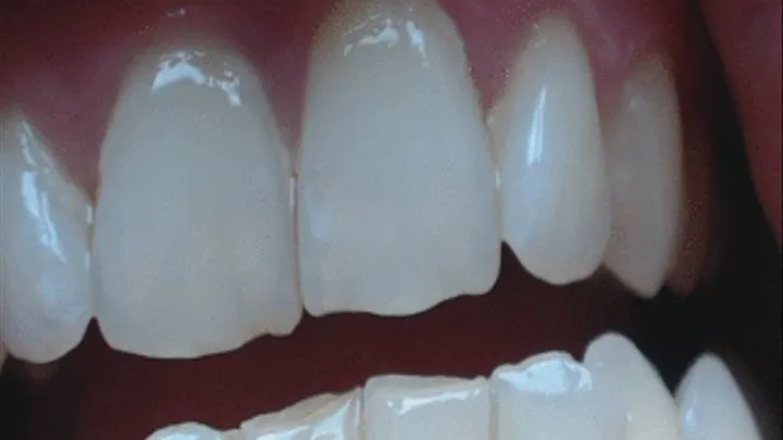 8 minutes white teeth to cam in close up