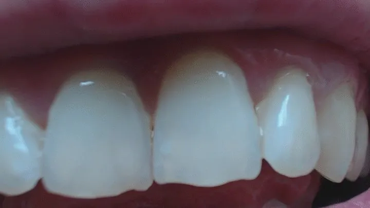 5 minutes white teeth to cam in close up