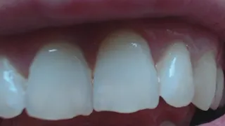 5 minutes white teeth to cam in close up