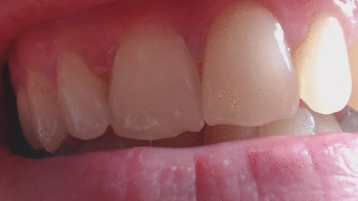 16 minutes of close up of my teeth