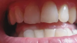 12 minutes teeth in close up