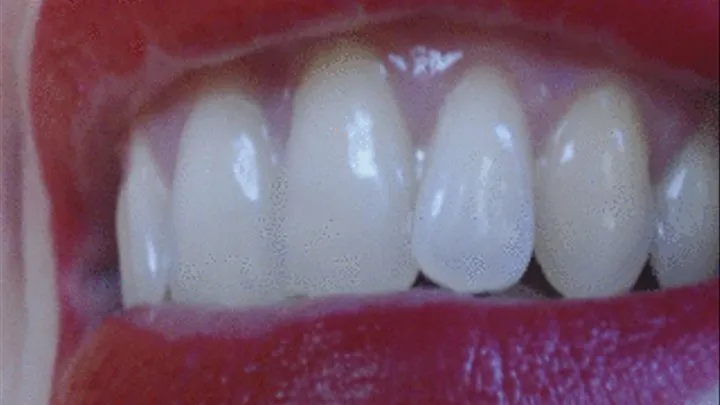 7 minutes super white teeth after scaling