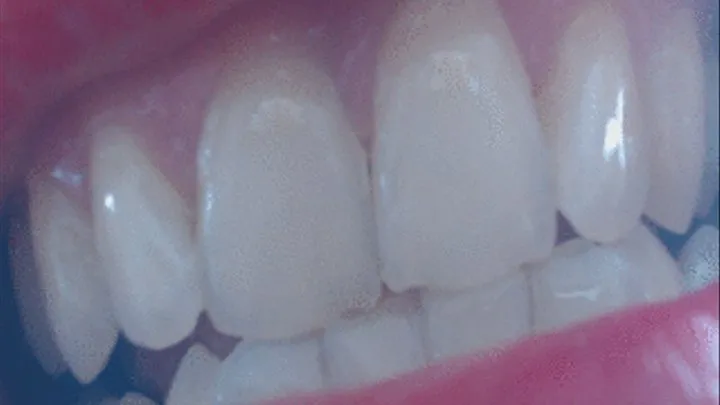 35 minutes with my white teeth whiter than ever