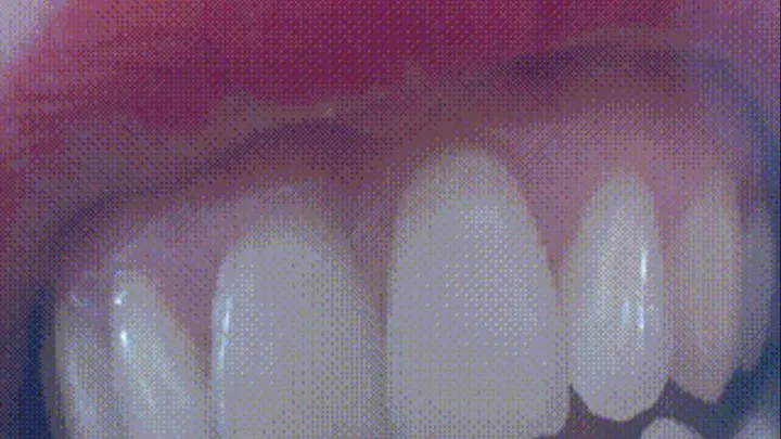 2 minutes super white teeth in close up for you