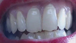 9 minutes teeth to cam