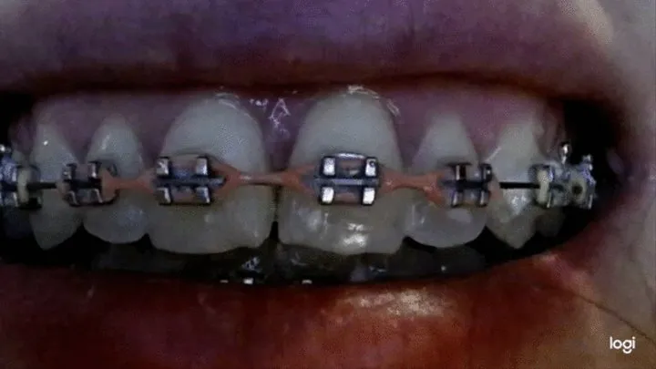 The teeth in brazes in close up to cam