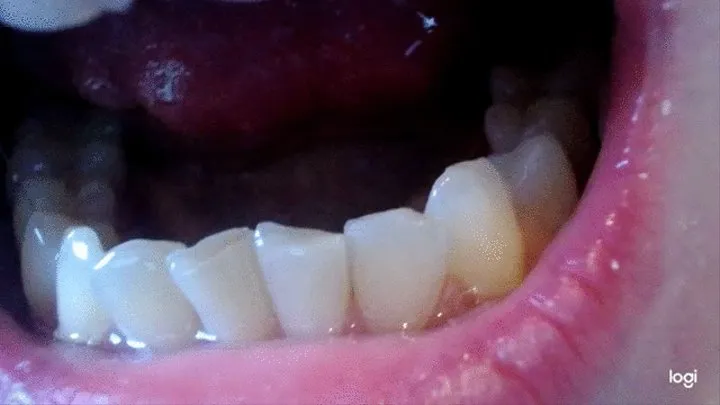 10 minutes od teeth in close up