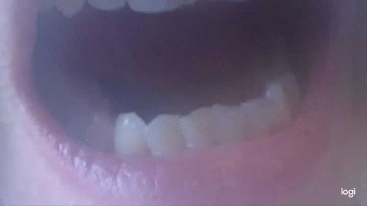 22 minutes teeth to cam No sound No audio