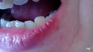 12 minutes of my teeth to cam No sound No audio