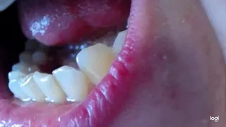 23 minutes my teeth to cam No sound No audio