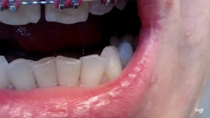 19 minutes of my teeth to cam No audio No sound