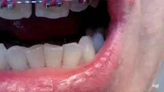19 minutes of my teeth to cam No audio No sound