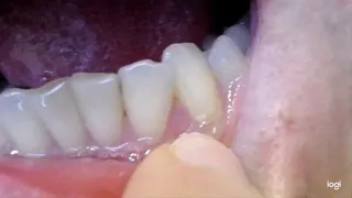 15 minutes of my teeth to cam No sound No audio