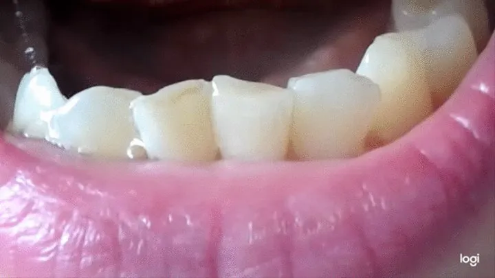 8 minutes of my teeth to cam